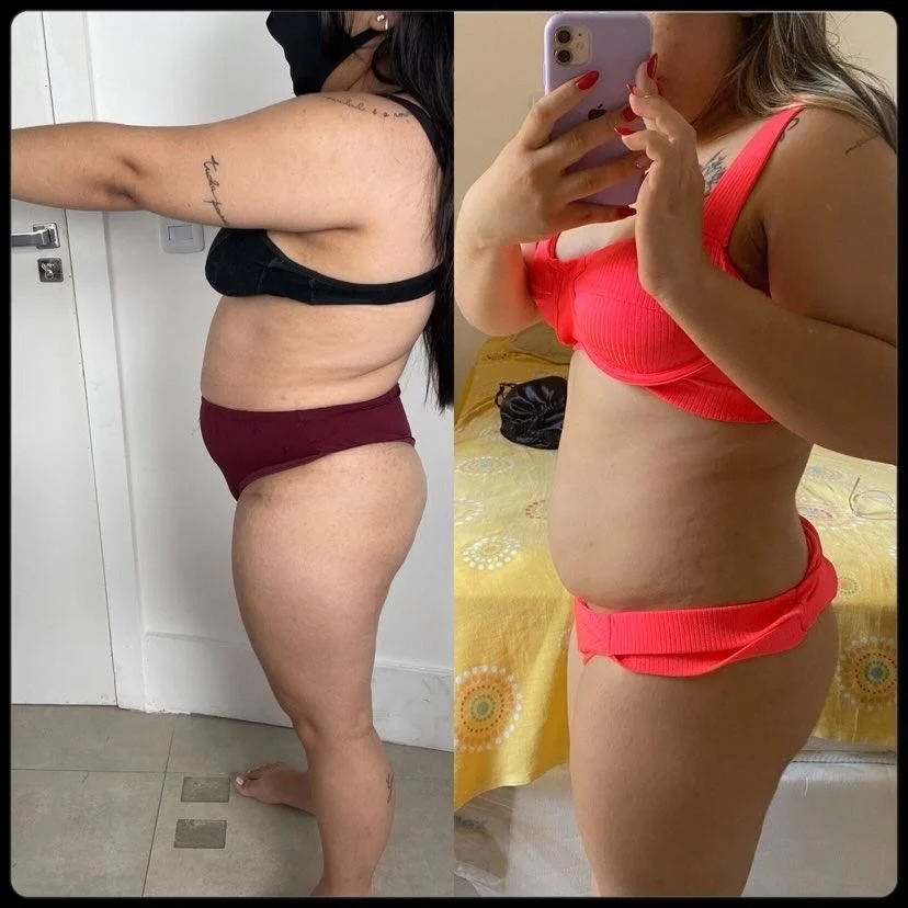 Antes y después — transformación real 1