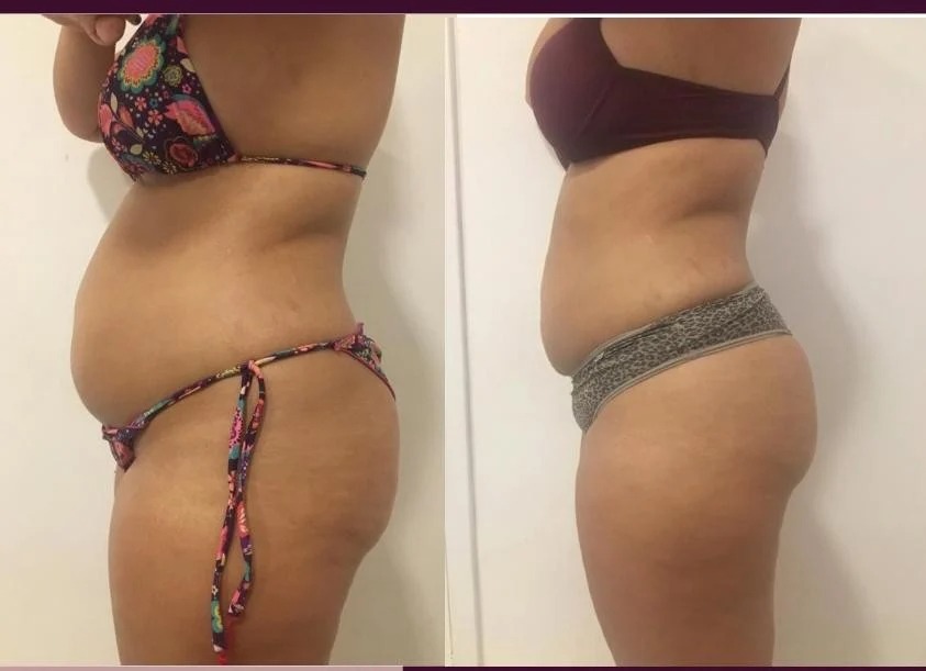 Antes y después — transformación real 3