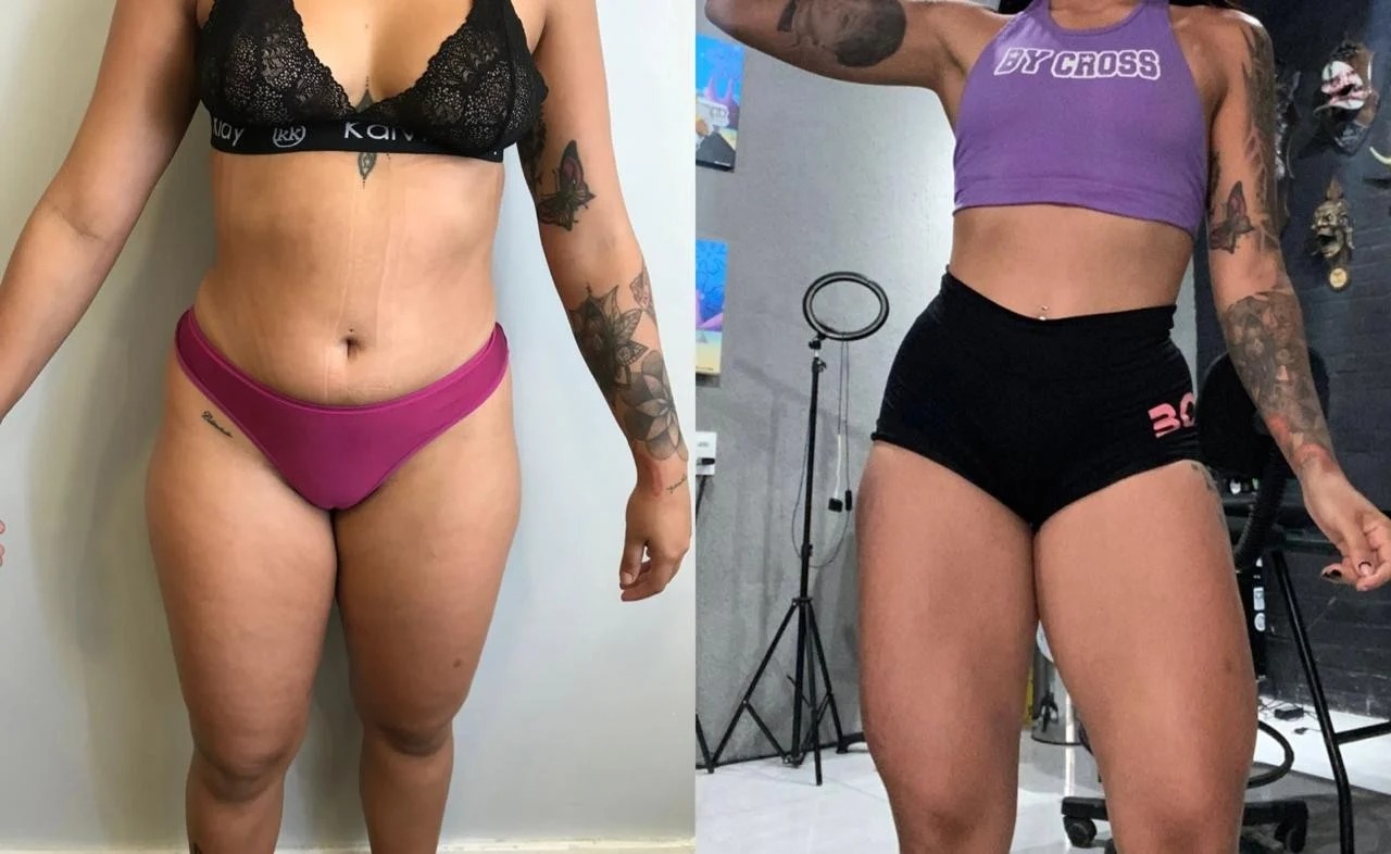Antes y después — transformación real 7