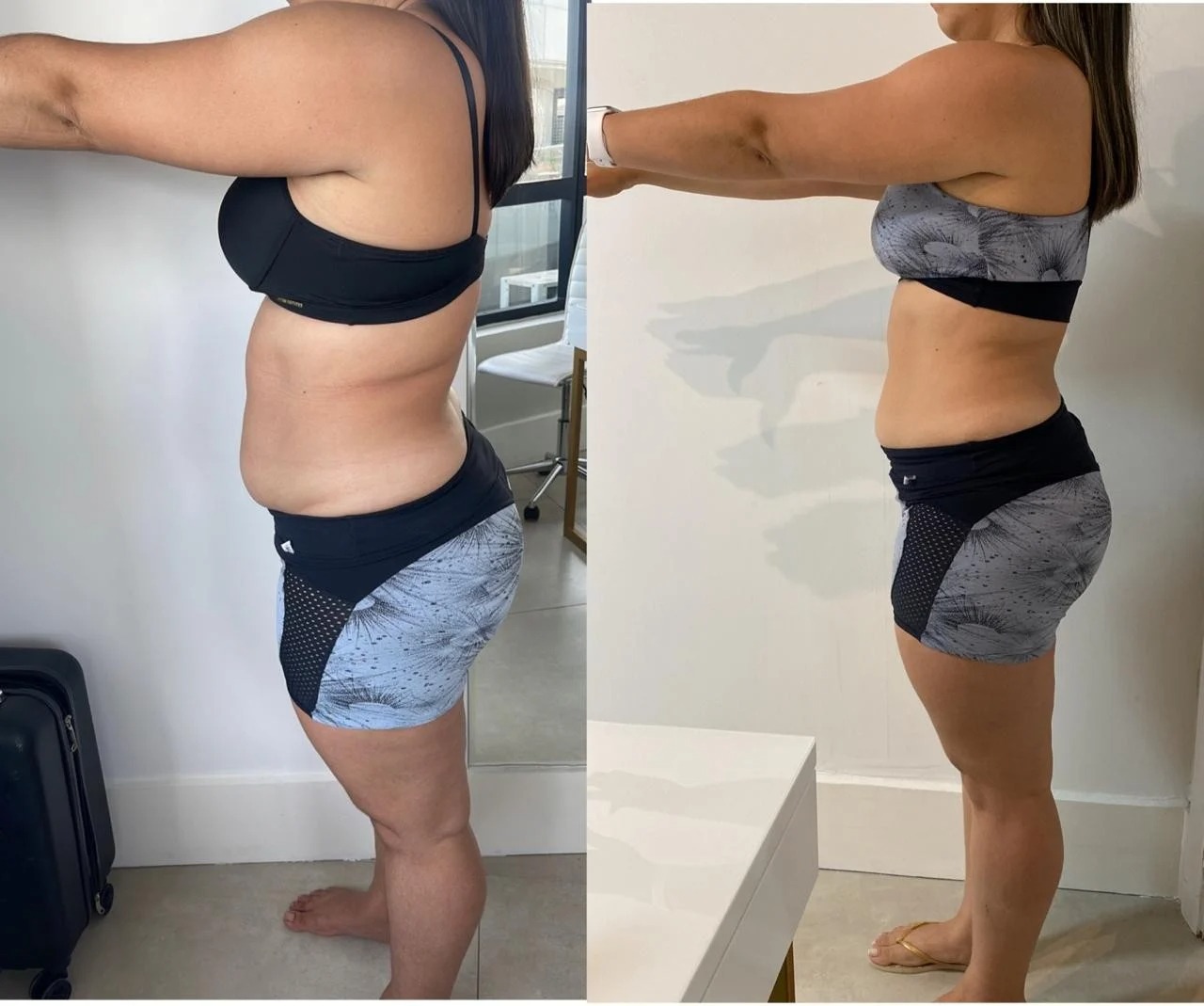 Antes y después — transformación real 9